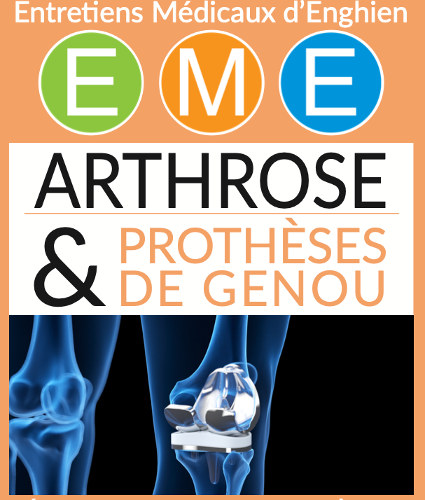 entretien médicaux - arthrose et prothèse de genou
